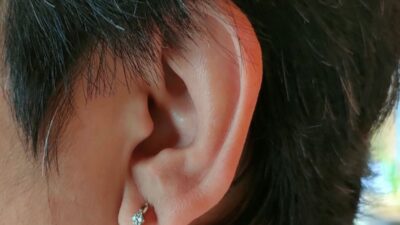 Telinga kerap berdenging? kenali gejala kemudian juga pendorong tinnitus