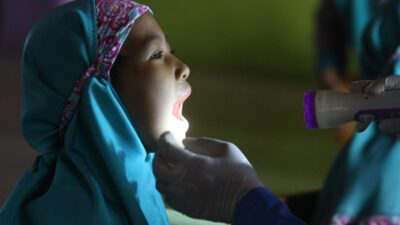 Kenali jenis gigi berikutnya tahapan peningkatan gigi pada bayi dan juga anak-anak