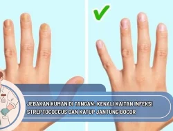 Jebakan Kuman di Tangan: Kenali Kaitan Infeksi Streptococcus dan Katup Jantung Bocor
