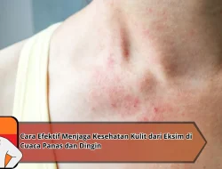 Cara Efektif Menjaga Kesehatan Kulit dari Eksim di Cuaca Panas dan Dingin