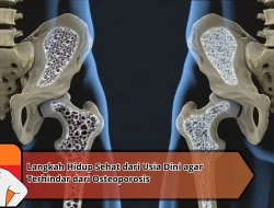 Langkah Hidup Sehat dari Usia Dini agar Terhindar dari Osteoporosis