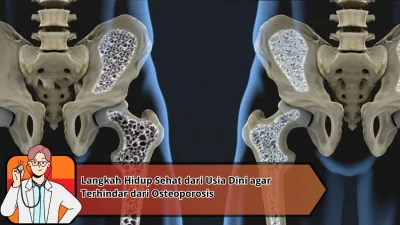 Langkah Hidup Sehat dari Usia Dini agar Terhindar dari Osteoporosis