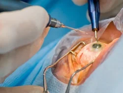 Panduan Tips Sehat Pasca Operasi Korneo Mata Untuk Harian