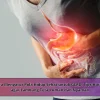 Cara Mengatur Pola Hidup Sehat untuk GERD: Tips Harian agar Lambung Tetap Aman dan Nyaman