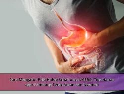 Cara Mengatur Pola Hidup Sehat untuk GERD: Tips Harian agar Lambung Tetap Aman dan Nyaman
