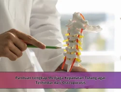 Panduan Lengkap Menjaga Kepadatan Tulang agar Terhindar dari Osteoporosis