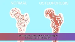 Tips Kesehatan Tulang Terbaru untuk Mencegah Osteoporosis di Usia Produktif