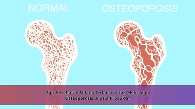 Tips Kesehatan Tulang Terbaru untuk Mencegah Osteoporosis di Usia Produktif