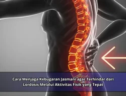 Cara Menjaga Kebugaran Jasmani agar Terhindar dari Lordosis Melalui Aktivitas Fisik yang Tepat