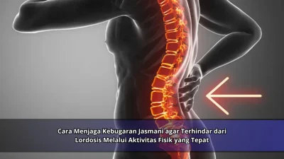 Cara Menjaga Kebugaran Jasmani agar Terhindar dari Lordosis Melalui Aktivitas Fisik yang Tepat