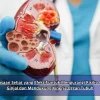 Kebiasaan Sehat yang Efektif untuk Mengurangi Risiko Gagal Ginjal dan Mendukung Kinerja Organ Tubuh