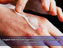 Langkah Sederhana Menjaga Kulit Tetap Sehat dan Mencegah Eksim Kambuh