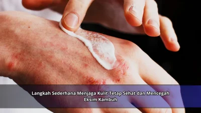 Langkah Sederhana Menjaga Kulit Tetap Sehat dan Mencegah Eksim Kambuh