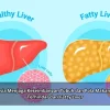 Rahasia Menjaga Keseimbangan Tubuh dan Pola Makan agar Terhindar dari Fatty Liver