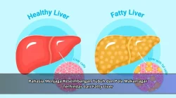 Rahasia Menjaga Keseimbangan Tubuh dan Pola Makan agar Terhindar dari Fatty Liver