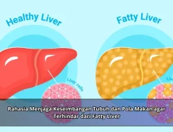 Rahasia Menjaga Keseimbangan Tubuh dan Pola Makan agar Terhindar dari Fatty Liver