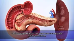 Panduan Menjaga Kesehatan Limpa demi Sistem Imun yang Lebih Optimal dan Seimbang