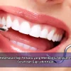 Tips Kesehatan Gigi Terbaru yang Membantu Senyum Tetap Cerah dan Gigi Lebih Kuat