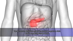 Tips Kesehatan Pankreas untuk Mendukung Pengaturan Gula Darah dan Metabolisme Tubuh